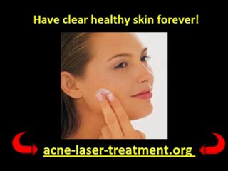 Acne Treatment with Fotona Laser