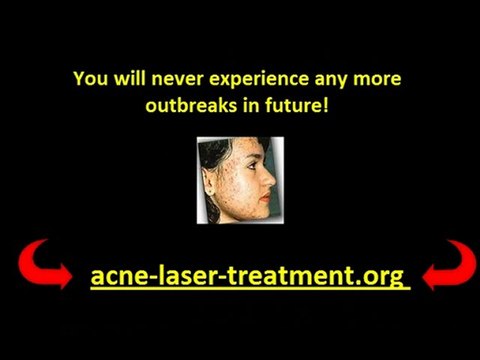 cystic acne treatment