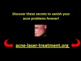 acne skin care treatment