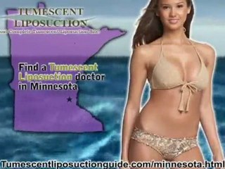 Tumescent Liposuction Minnesota