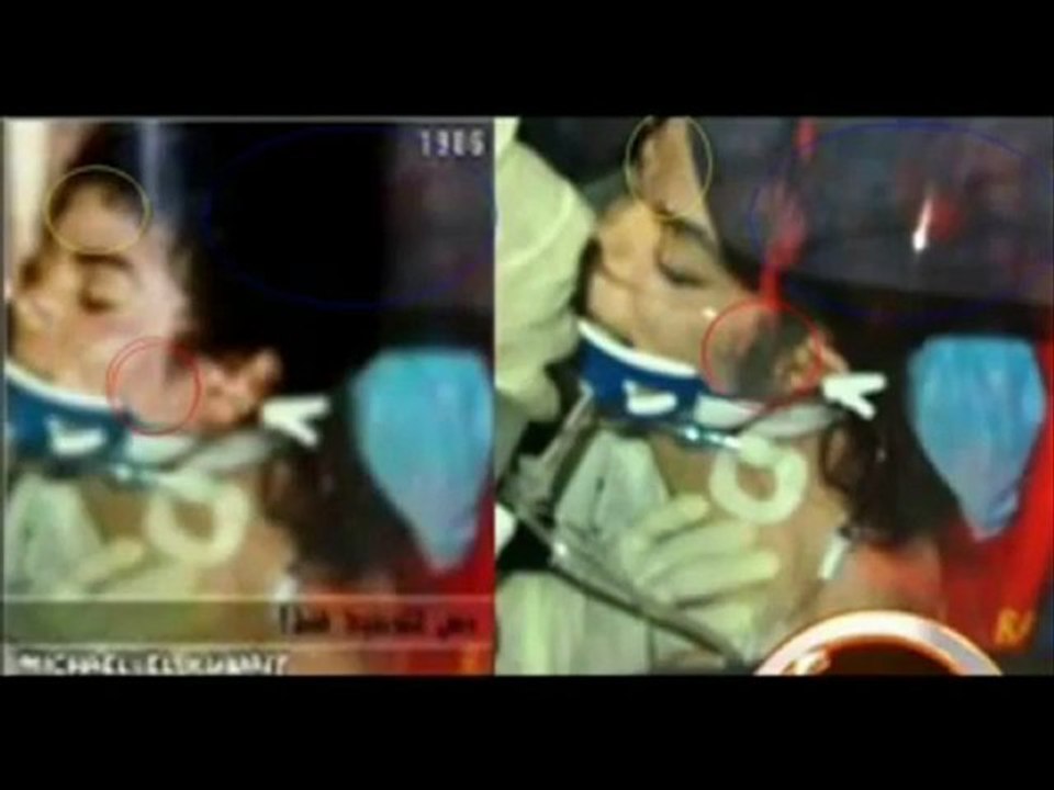 Mort ? ou vivant ! michael jackson 2 part