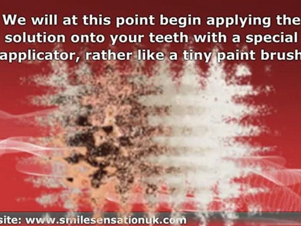 Teeth Whitening - The Safe Way.