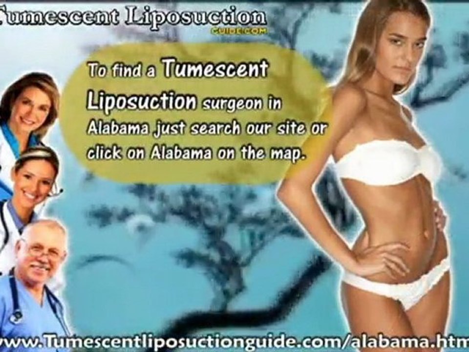 Tumescent Liposuction Alabama