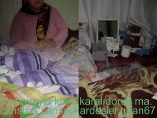 CANSU,CANSEL KARDEŞLER.CİĞER NAKLİ GEREKLİ.