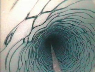 Une "crevette" surprise en Antarctique