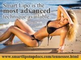 Smart Lipo Top Docs Tennessee