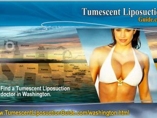 Tumescent Liposuction Washington