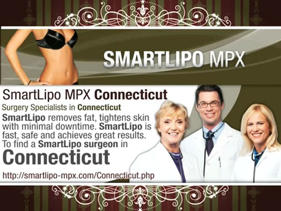 Smart Lipo Connecticut
