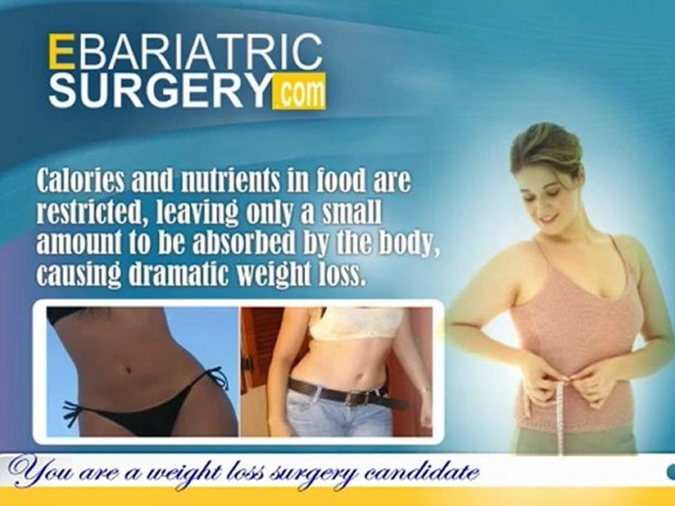 Bariatric Surgery