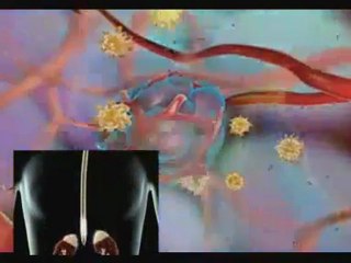 DR ÖMER COŞKUN ROMATİZMA SETİ