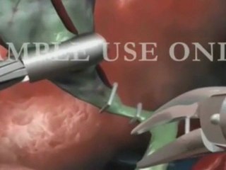 Pass Your Gallstones Pain Free!