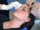 Sunderland Botox -Claire - Botox - Olivers Dental Studio