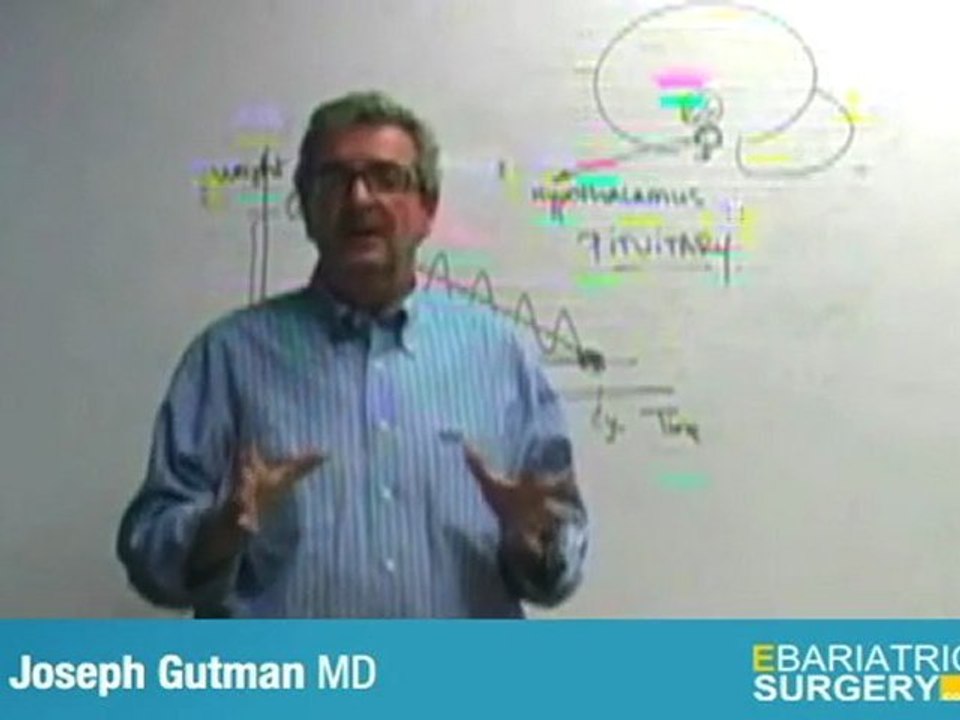 Bariatric Surgery