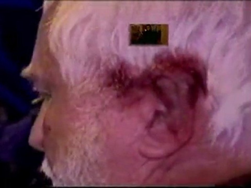 Saga de la Folie Humaine  Mind Control Part III