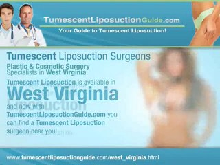 Tumescent Liposuction West Virginia