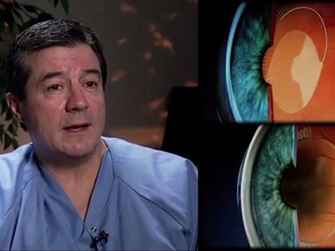 Removing Cataracts Permanently & Painlessly - Barnet Dulaney