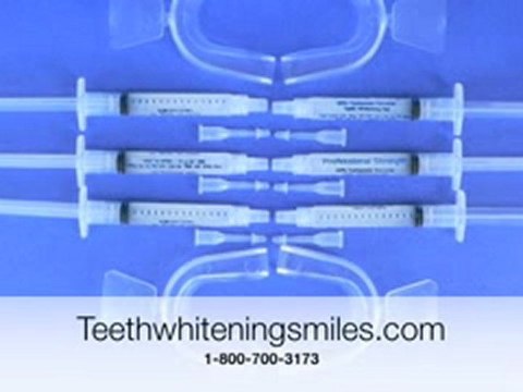 Is Teeth Whitening Permanent?