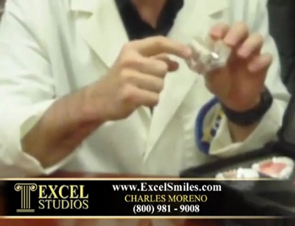 Dental Implant by Dr.Moreno|Dental Presentation Models in 9