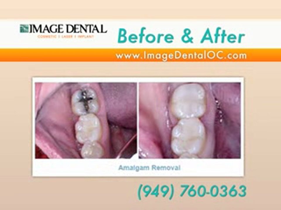 Image Dental OC - Dentist, Cosmetic, Implant and Laser
