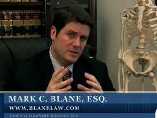 California Slip and Fall Attorney (Trip & Fall): Negligence