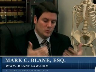 California Personal Injury Attorney: Injury Case Value