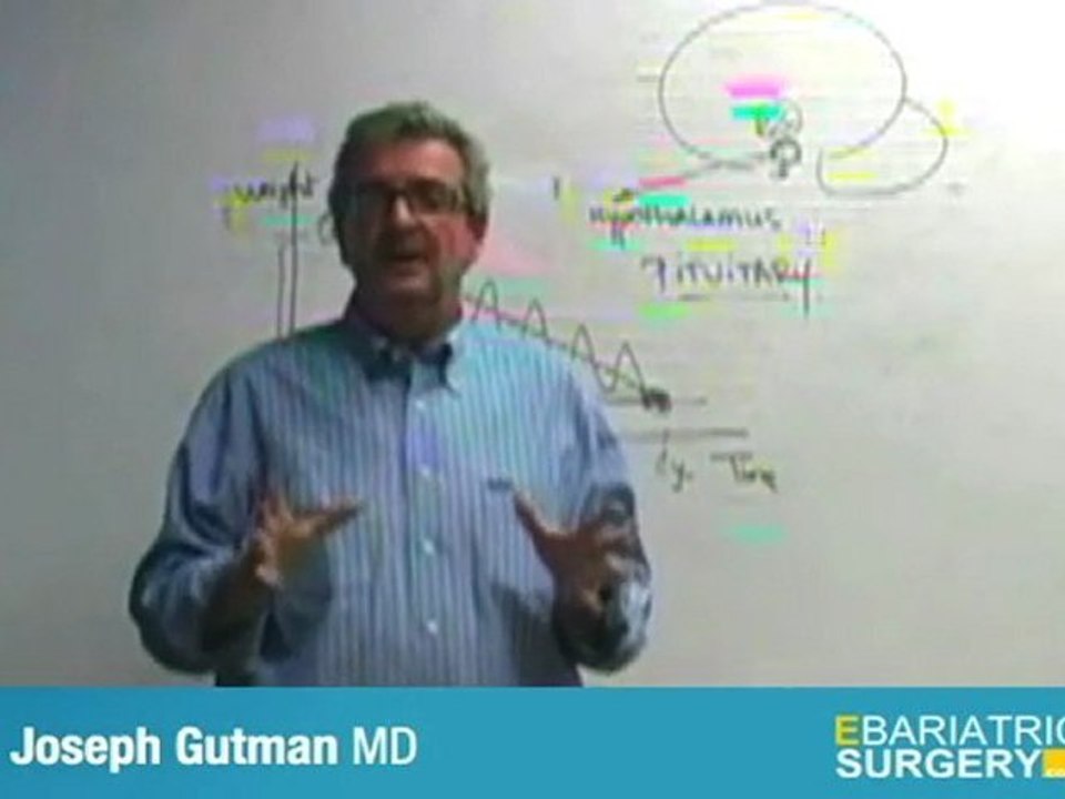 Bariatric Surgery