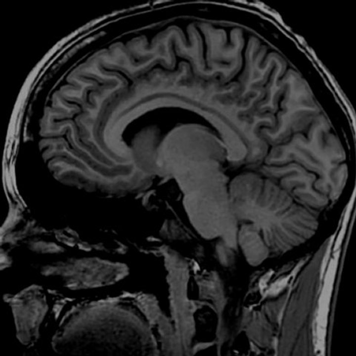 High resolution 3D MR image of the brain
