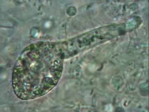 Stentor ceruleum ??? A identifier