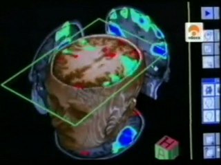 ¿Mozart nos hace mas listos?: El efecto Mozart