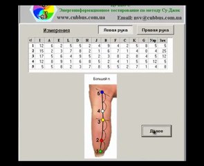 Компьютерная диагностика ЦУББУС в акупунктуре Су-Джок