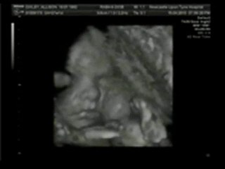 Amy Rose 4D Scan April 2010