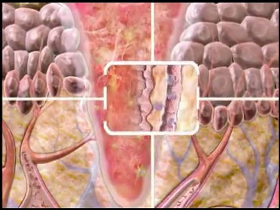 Wound Healing