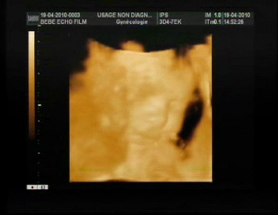 echo 3d de notre puce