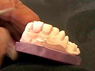 Comment faire une découpe dentinaire naturelle