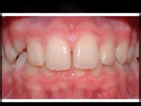 Greeley Orthodontist - Super Smiles By Doctor K