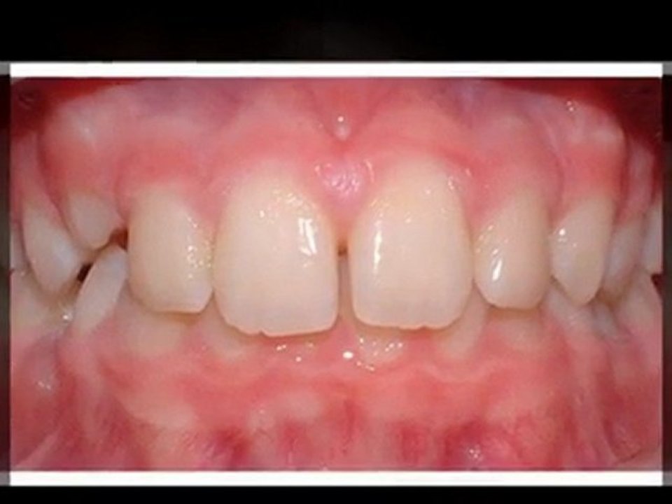 Greeley Orthodontist - Super Smiles By Doctor K