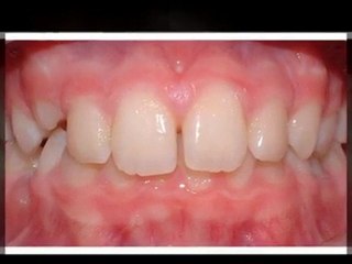 Greeley Orthodontist - Super Smiles By Doctor K