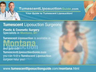 Tumescent Liposuction Montana