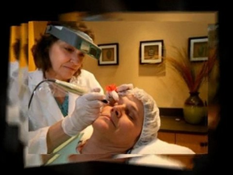 Get Rid of Spider Veins - How to Treat Spider Vein