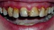 Gold coast cosmetic dentist Bright Smiles At Cosmetic Dental