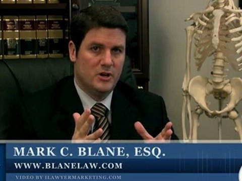 Chula Vista Slip/Trip & Fall Injury: Premise Liability Law