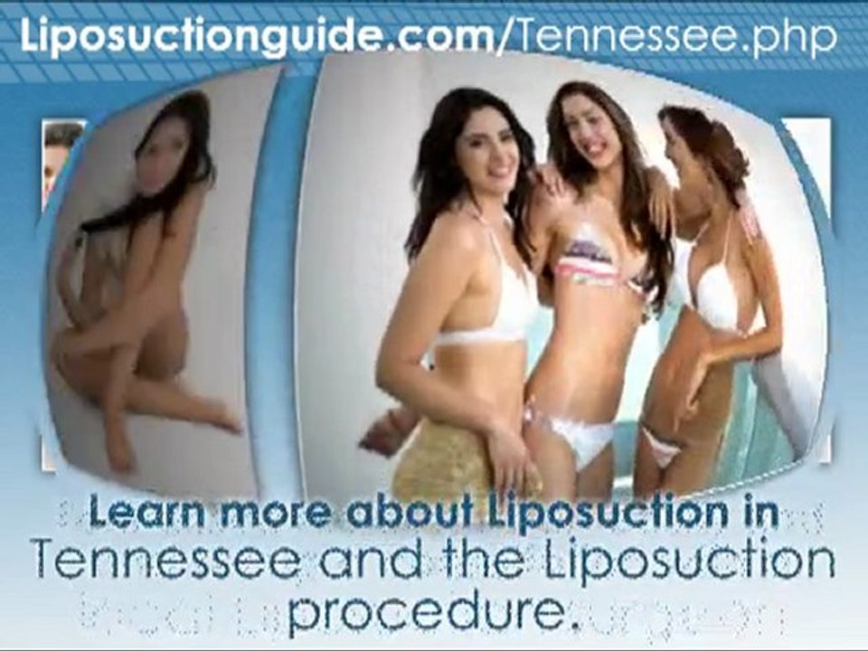 Liposuction Tennessee