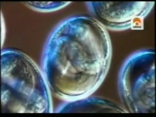 Alergias y anticuerpos IgE