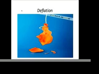 Gold, Inflation and Deflation