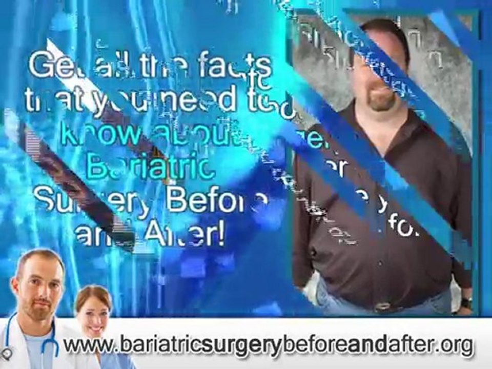 Bariatric Surgery Before And After