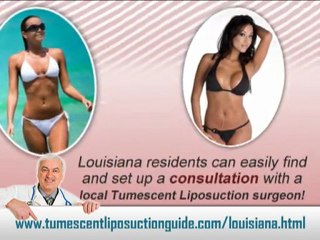 Tumescent Liposuction Louisiana