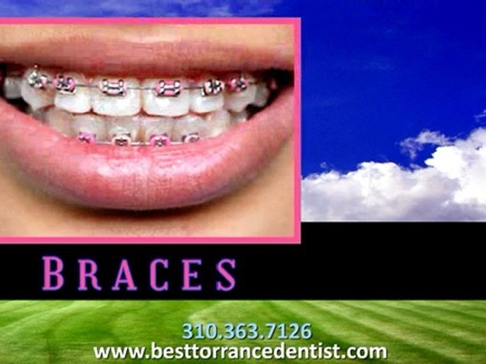 Best Torrance Dentist - Redondo Beach Dentist - Blue Sky Fam