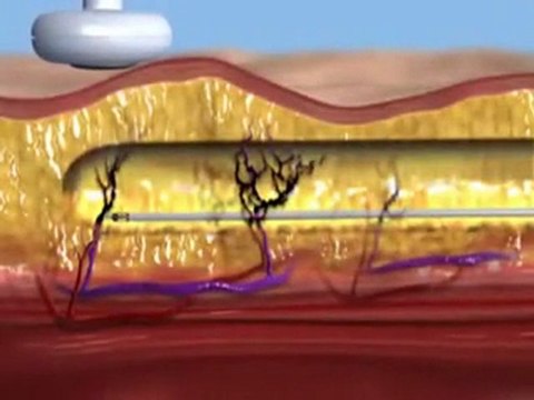 Manhattan Plastic Surgery, Body Contouring NYC