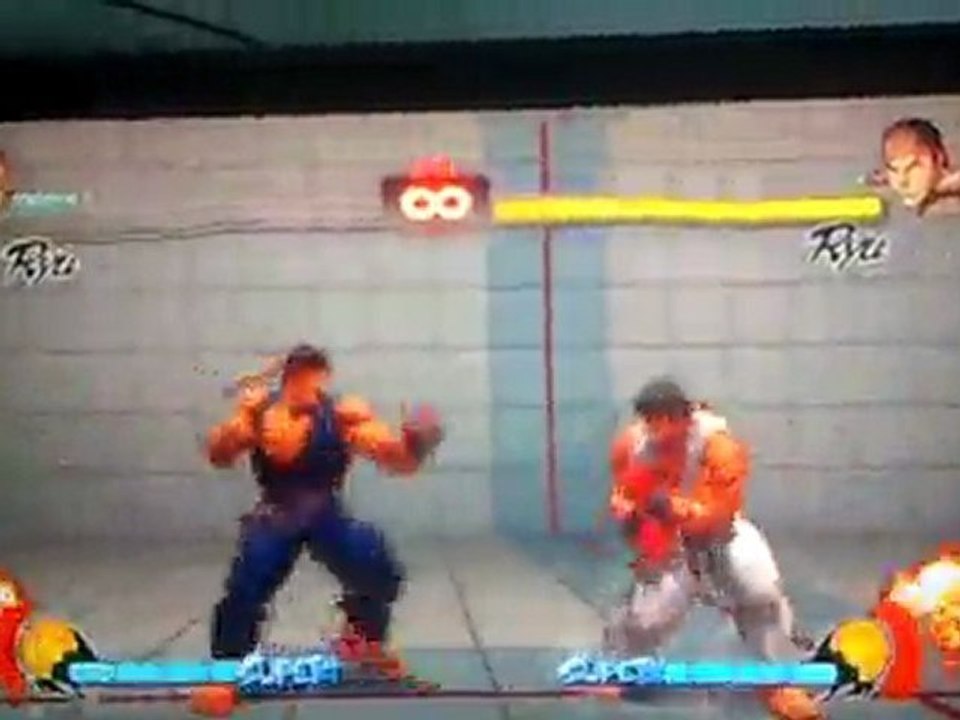 Mon FADC to Ultra avec Ryu