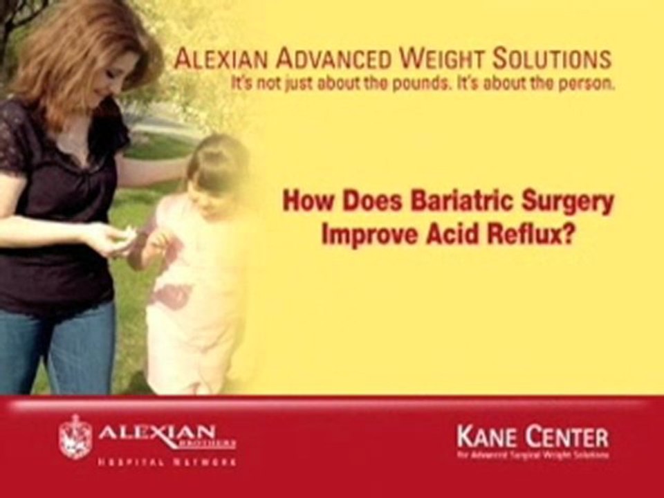 Acid Reflux & Bariatric Surgery – Suburban Surgical Care IL
